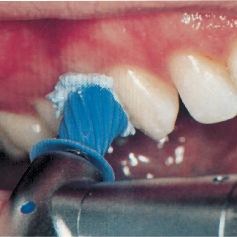 denta-tec-220260710175932650938
